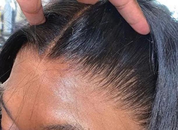 Ratchetly Raw Frontals