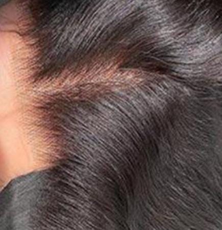 Ratchetly Raw Frontals